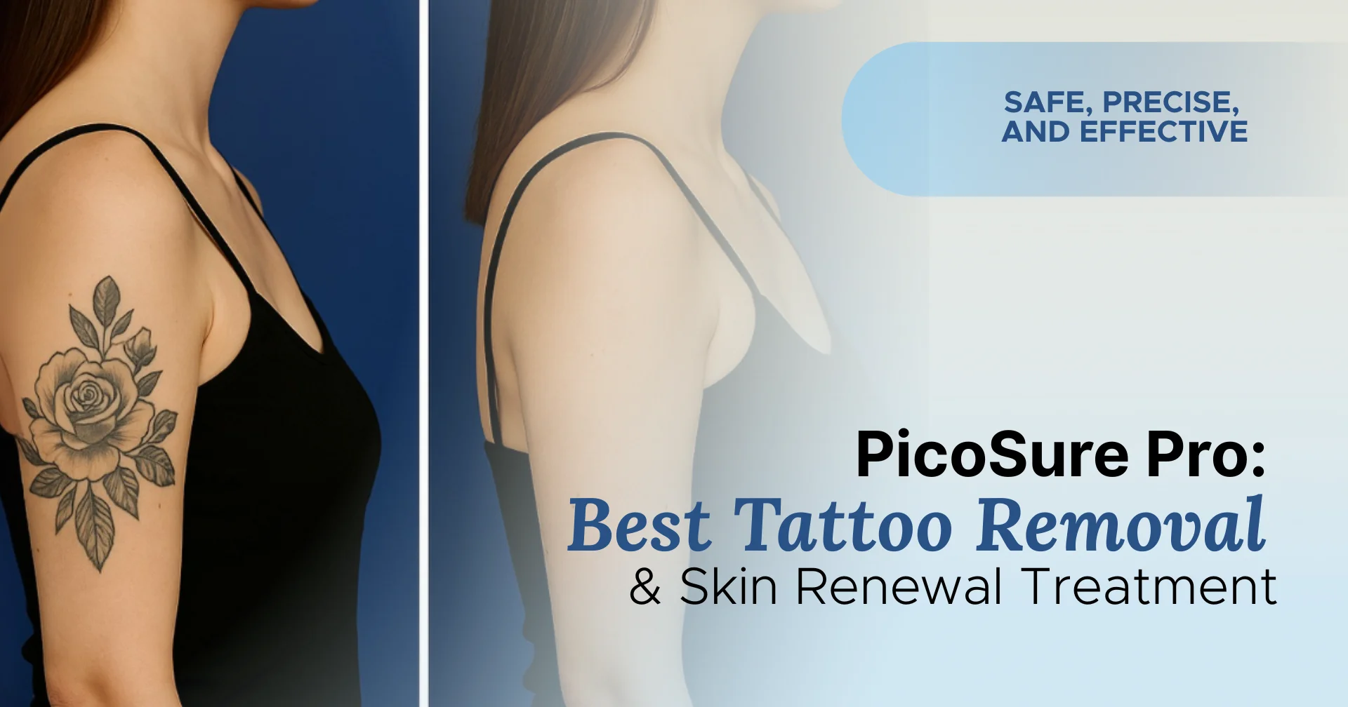 PicoSure Pro Best Tattoo Removal & Skin Renewal Treatment