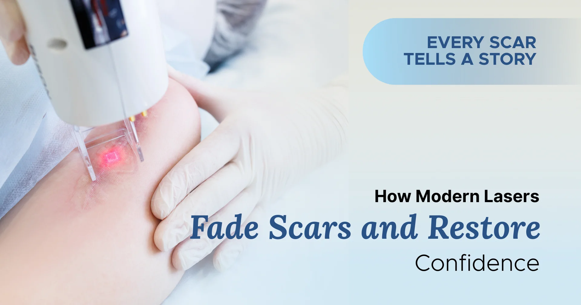 How Modern Lasers Fade Scars and Restore Confidence