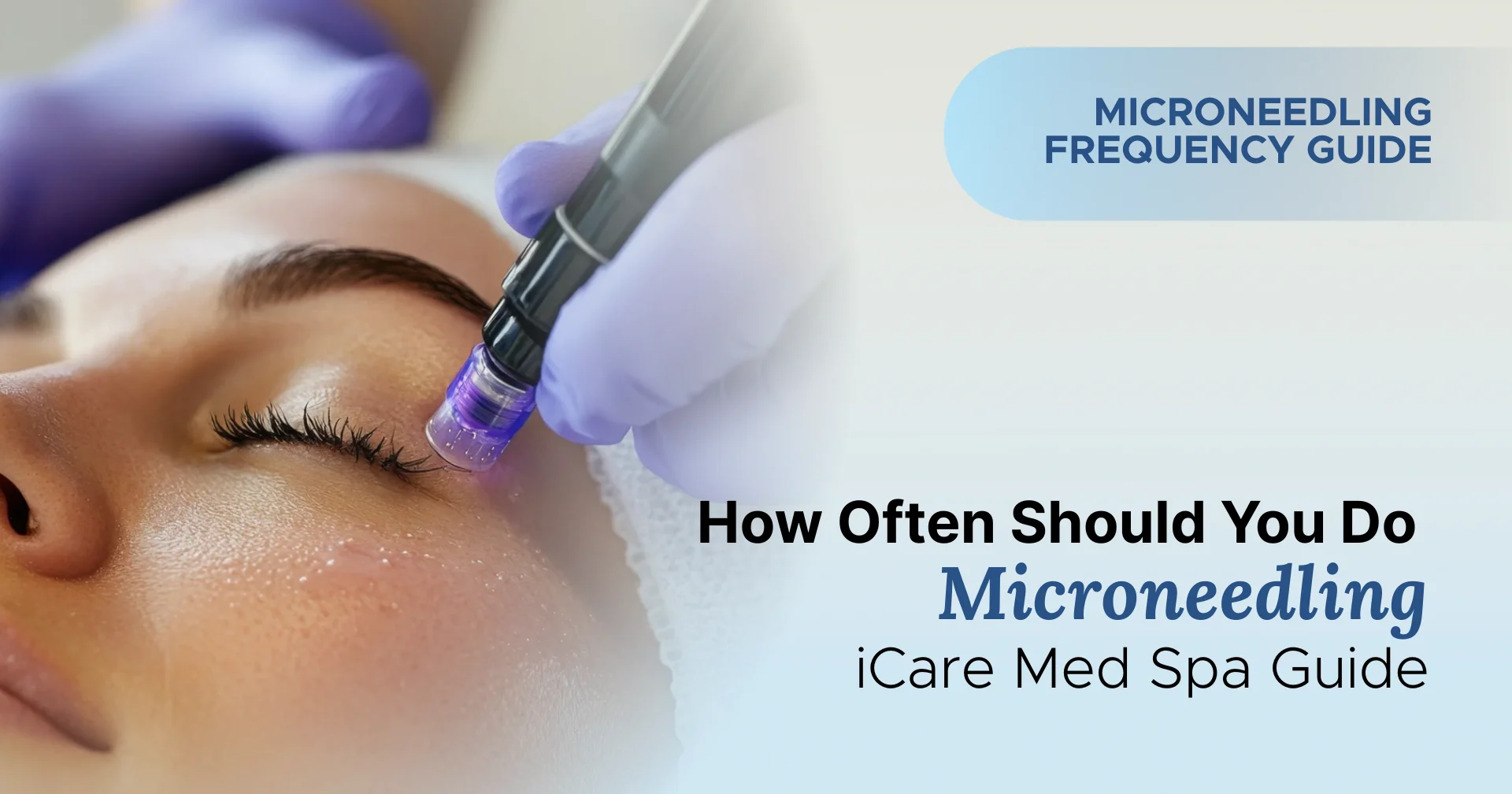 How Often Should You Do Microneedling