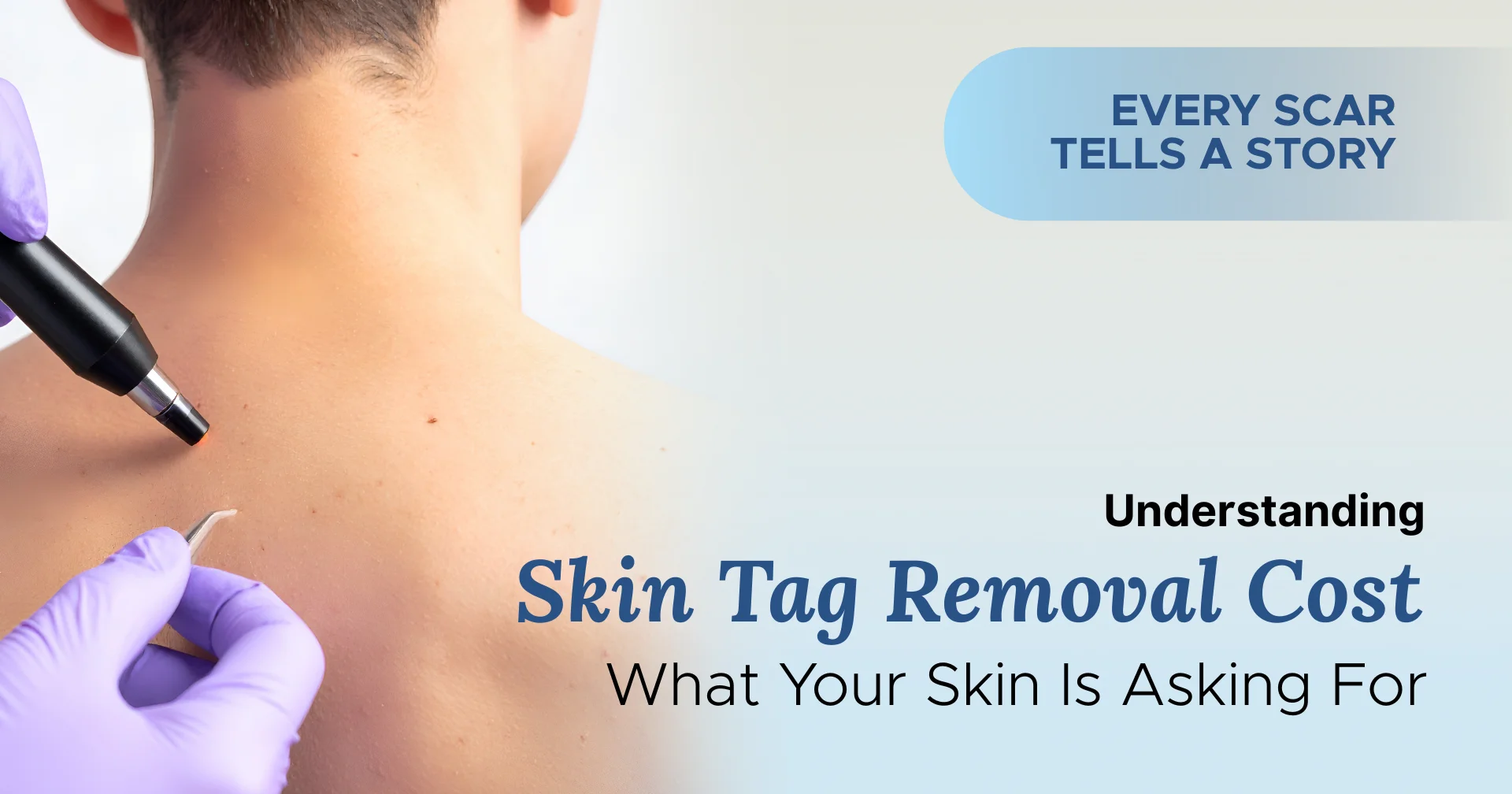 Understanding Skin Tag Removal Cost